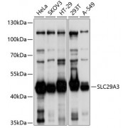 Western blot analysis of extracts of various cell lines, using SLC29A3 antibody (abx126574) at 1/1000 dilution.