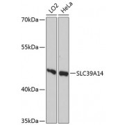 Western blot analysis of extracts of various cell lines, using SLC39A14 antibody (abx126581) at 1/1000 dilution.