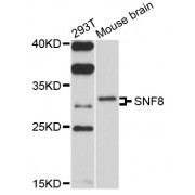 Western blot analysis of extracts of various cell lines, using SNF8 antibody (abx126611) at 1/1000 dilution.