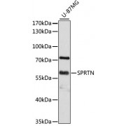 Western blot analysis of extracts of U-87MG cells, using SPRTN Antibody (abx126635) at 1/3000 dilution.