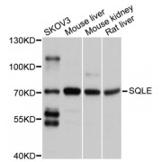 Western blot analysis of extracts of various cell lines, using SQLE antibody (abx126641) at 1/1000 dilution.
