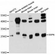 Western blot analysis of extracts of various cell lines, using SSPN antibody (abx126651) at 1:3000 dilution.