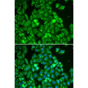 Immunofluorescence analysis of HeLa cells using STAT1 antibody (abx126657). Blue: DAPI for nuclear staining.