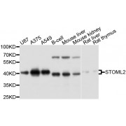 Western blot analysis of extracts of various cell lines, using STOML2 antibody (abx126669) at 1/1000 dilution.