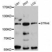 Western blot analysis of extracts of various cell lines, using STRA6 antibody (abx126670) at 1:3000 dilution.