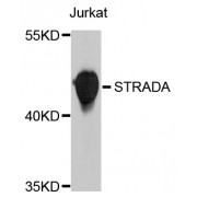 Western blot analysis of extracts of Jurkat cells, using STRADA antibody (abx126671) at 1/1000 dilution.
