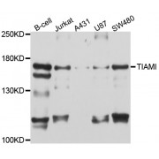 Western blot analysis of extracts of various cell lines, using TIAM1 antibody (abx126703) at 1/1000 dilution.