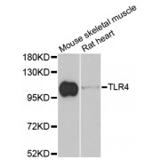 Western blot analysis of extracts of various cell lines, using TLR4 antibody (abx126710) at 1/1000 dilution.