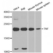 Western blot analysis of extracts of various cell lines, using TNF antibody (abx126717) at 1/1000 dilution.