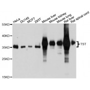 Western blot analysis of extracts of various cell lines, using TST antibody (abx126747) at 1/1000 dilution.