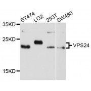Western blot analysis of extracts of various cell lines, using VPS24 antibody (abx126787) at 1/1000 dilution.