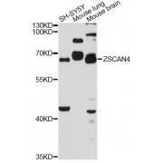 Western blot analysis of extracts of various cell lines, using ZSCAN4 antibody (abx126811) at 1:3000 dilution.