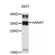 Western blot analysis of extracts of 293T cells, using AANAT antibody (abx126816) at 1/1000 dilution.