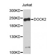 Western blot analysis of extracts of Jurkat cells, using DOCK2 antibody (abx126888).