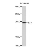 Western blot analysis of extracts of NCI-H460 cells, using IL13 antibody (abx126946).