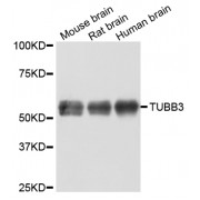 Western blot analysis of extracts of various cell lines, using TUBB3 antibody (abx127119).