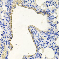 Protein Kinase N1 (PKN1) Antibody