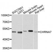 Western blot analysis of extracts of various cell lines, using CHRNA7 antibody (abx135721) at 1/1000 dilution.