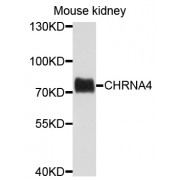 Western blot analysis of extracts of mouse kidney, using CHRNA4 antibody (abx135722) at 1/1000 dilution.