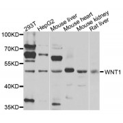 Western blot analysis of extracts of various cell lines, using WNT1 antibody (abx135727) at 1/1000 dilution.
