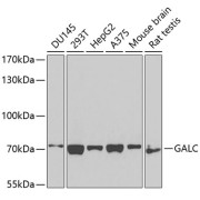 Western blot analysis of extracts of various cell lines (25 µg per lane), using GALC antibody (1/1000 dilution), followed by Goat Anti-Rabbit IgG, H+L (https://www.abbexa.com/index.php?route=product/search&amp;search=abx005548" target="_blank">abx005548</a>, 1/10000 µg/ml) and 3% non-fat dry milk in TBST for blocking.