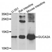 Western blot analysis of extracts of various cell lines, using GUCA2A antibody (abx135764) at 1/1000 dilution.