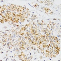Myosin VA (MYO5A) Antibody
