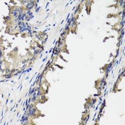 Ornithine Carbamoyltransferase, Mitochondrial (OTC) Antibody