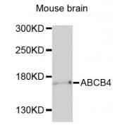 Western blot analysis of extracts of mouse brain, using ABCB4 antibody (abx135779) at 1/1000 dilution.