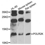 Western blot analysis of extracts of various cell lines, using POLR2K antibody (abx135780) at 1/1000 dilution.