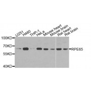 Western blot analysis of extracts of various cell lines, using RPE65 antibody (abx135785) at 1/1000 dilution.
