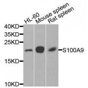Western blot analysis of extracts of various cell lines, using S100A9 antibody (abx135786) at 1/1000 dilution.