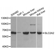 Western blot analysis of extracts of various cell lines, using SLC2A2 antibody (abx135787) at 1/1000 dilution.