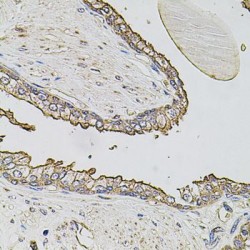 ATP Binding Cassette Transporter C3 (ABCC3) Antibody