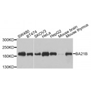 Western blot analysis of extracts of various cell lines, using BAZ1B antibody (abx135795) at 1/1000 dilution.