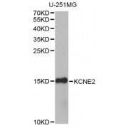 Western blot analysis of extracts of U-251MG cells, using KCNE2 antibody (abx135803) at 1/1000 dilution.