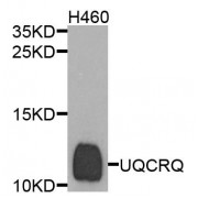 Western blot analysis of extracts of H460 cells, using UQCRQ antibody (abx135816) at 1/1000 dilution.