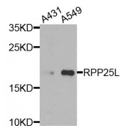 Western blot analysis of extracts of various cell lines, using RPP25L antibody (abx135833) at 1/1000 dilution.