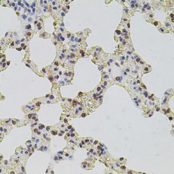 Histone Cluster 1, H2ag (HIST1H2AG) Antibody