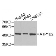 Western blot analysis of extracts of various cell lines, using ATP1B2 antibody (abx135848) at 1/1000 dilution.
