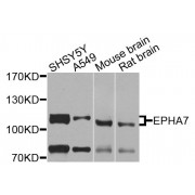 Western blot analysis of extracts of various cell lines, using EPHA7 antibody (abx135851) at 1/1000 dilution.