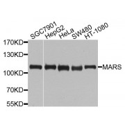 Western blot analysis of extracts of various cell lines, using MARS antibody (abx135858) at 1/1000 dilution.