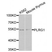 Western blot analysis of extracts of various cell lines, using PLRG1 antibody (abx135866) at 1/1000 dilution.