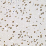 Immunohistochemistry of paraffin-embedded mouse brain using Smarcd1 antibody (abx135870) (40x lens).