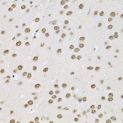 BRG1-Associated Factor 60A (BAF60a) Antibody