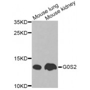 Western blot analysis of extracts of various cell lines, using G0S2 Antibody (abx135890) at 1/1000 dilution.