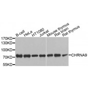 Western blot analysis of extracts of various cell lines, using CHRNA9 antibody (abx135895) at 1/1000 dilution.