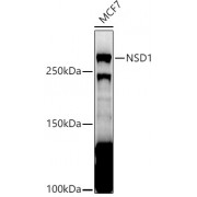 Western blot analysis of extracts of MCF7 cells (25 μg per lane), using NSD1 antibody (1/1000 dilution) followed by HRP-conjugated Goat Anti-Rabbit IgG H+L (<a href="https://www.abbexa.com/index.php?route=product/request&search=abx005548">abx005548</a>, 1/10000 dilution) and 3% non-fat dry milk in TBST for blocking.