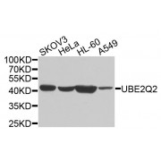 Western blot analysis of extracts of various cell lines, using UBE2Q2 antibody (abx135912) at 1/1000 dilution.