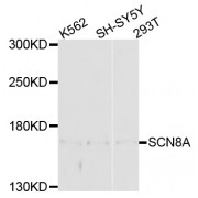 Western blot analysis of extracts of various cell lines, using SCN8A antibody (abx135926) at 1/1000 dilution.